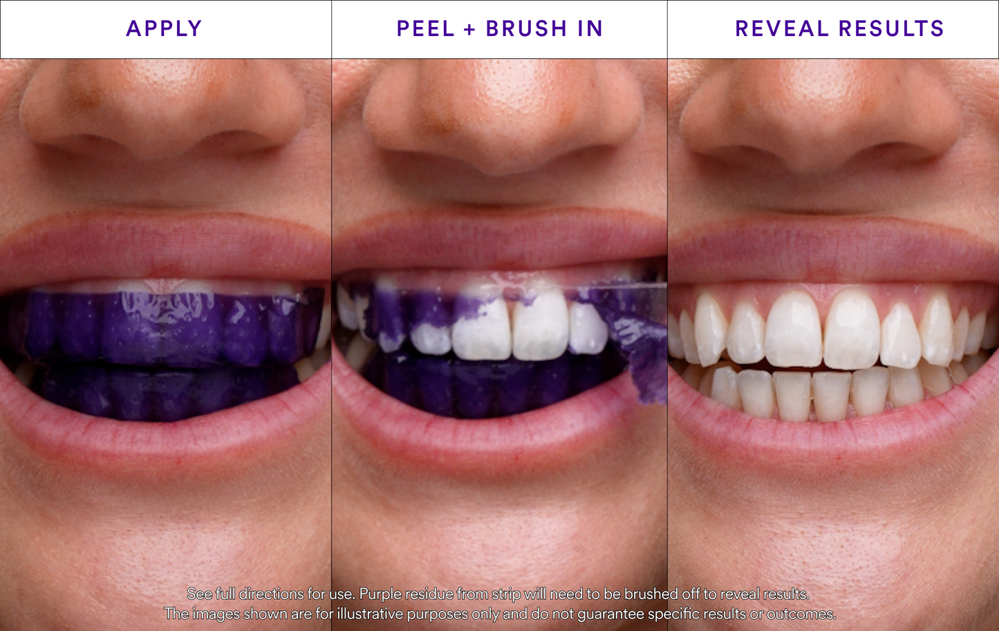 ✨ODALIT™ V34 Whitening Strips -Radiate a beautiful smile