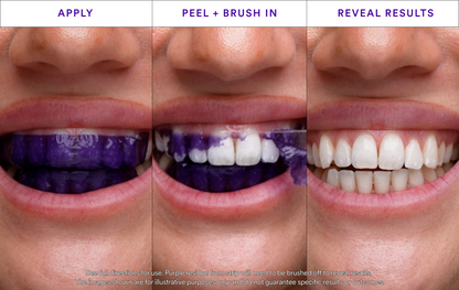 ✨ODALIT™ V34 Whitening Strips -Radiate a beautiful smile